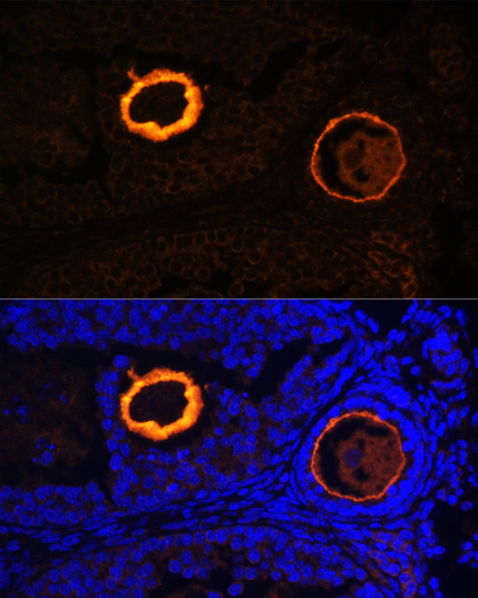 Immunofluorescence - ZP3 Polyclonal Antibody 