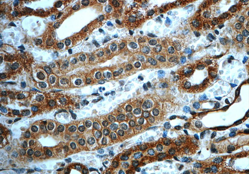 Immunohistochemistry of paraffin-embedded human kidney slide using Catalog No:113417(ORAI2 Antibody) at dilution of 1:50