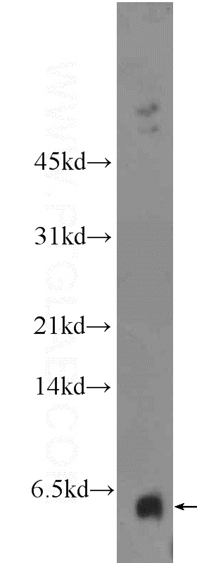 SH-SY5Y cells were subjected to SDS PAGE followed by western blot with Catalog No:110852(GALP Antibody) at dilution of 1:300