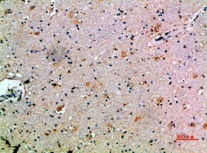 Fig1:; Immunohistochemical analysis of paraffin-embedded human-brain, antibody was diluted at 1:200