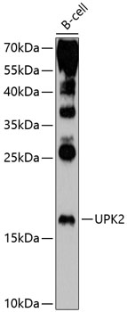 Western blot - UPK2 Polyclonal Antibody 