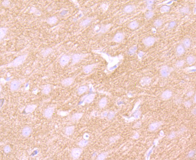 Fig4: Immunohistochemical analysis of paraffin-embedded rat brain tissue using anti- GABA B Receptor 2 antibody. Counter stained with hematoxylin.