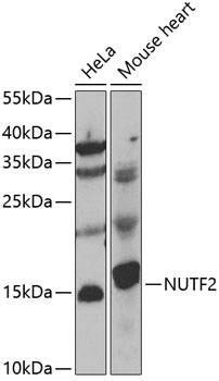 Western blot - NUTF2 Polyclonal Antibody 