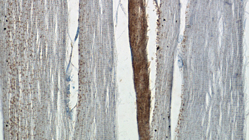 Immunohistochemistry of paraffin-embedded human skeletal muscle tissue slide using Catalog No:114606(RBM24 Antibody) at dilution of 1:50 (under 40x lens)