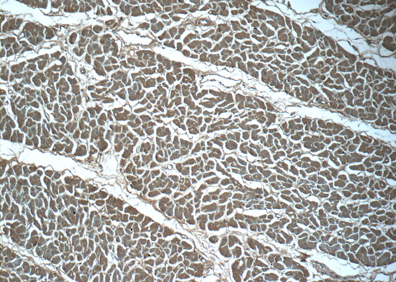 Immunohistochemistry of paraffin-embedded human heart tissue slide using Catalog No:114715(RIPK1-Specific Antibody) at dilution of 1:50 (under 10x lens)