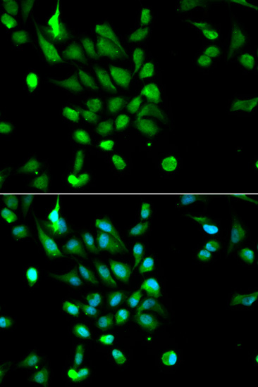Immunofluorescence - PSMC5 Polyclonal Antibody 