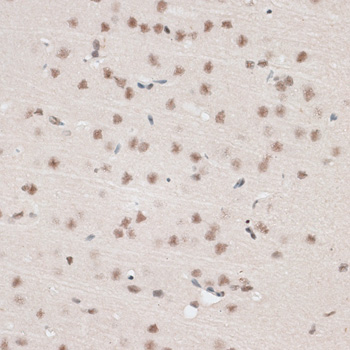 Immunohistochemistry - AQR Polyclonal Antibody 