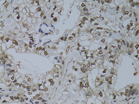 Immunohistochemistry - HUS1 Polyclonal Antibody 