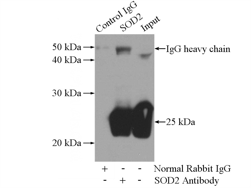 IP Result of anti-SOD2 (IP:Catalog No:115493, 4ug; Detection:Catalog No:115493 1:1000) with mouse brain tissue lysate 4000ug.
