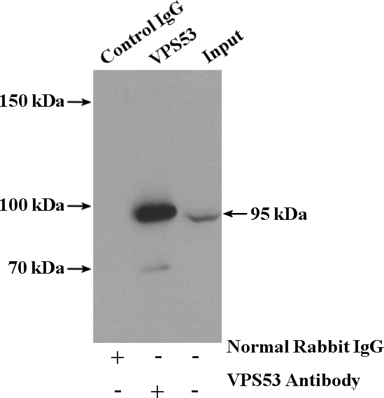 IP Result of anti-VPS53 (IP:Catalog No:116794, 4ug; Detection:Catalog No:116794 1:500) with mouse liver tissue lysate 4000ug.