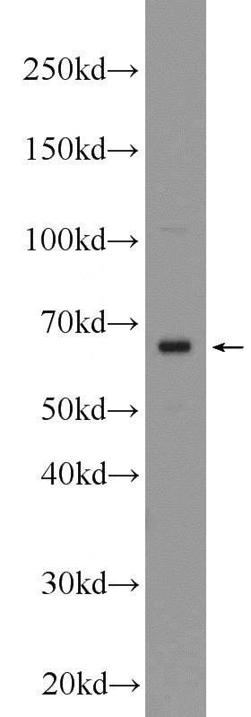 mouse colon tissue were subjected to SDS PAGE followed by western blot with Catalog No:110772(FZD2 Antibody) at dilution of 1:600