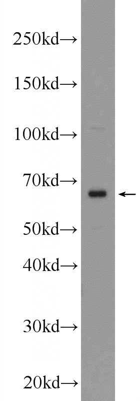 mouse colon tissue were subjected to SDS PAGE followed by western blot with Catalog No:110772(FZD2 Antibody) at dilution of 1:600