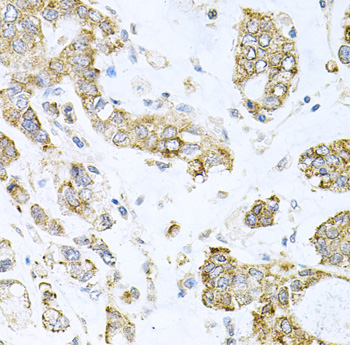 Immunohistochemistry - ALKBH8 Polyclonal Antibody 