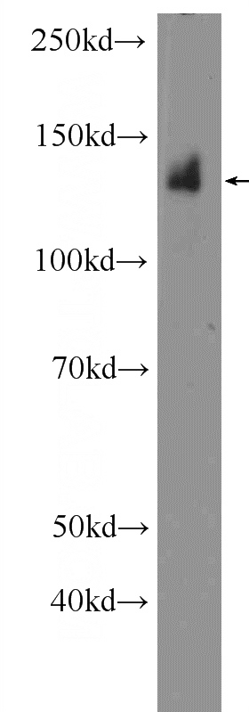 mouse thymus tissue were subjected to SDS PAGE followed by western blot with Catalog No:113143(NFATC3 Antibody) at dilution of 1:300