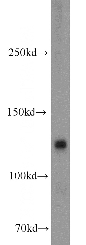 human brain tissue were subjected to SDS PAGE followed by western blot with Catalog No:109676(CYFIP2 antibody) at dilution of 1:1000