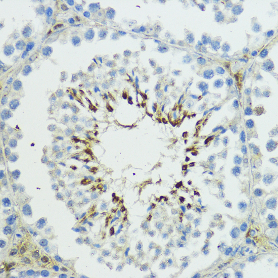 Immunohistochemistry - TRIP12 Polyclonal Antibody 
