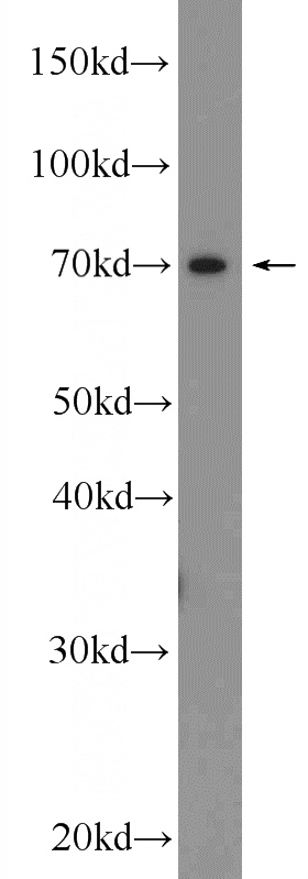 human placenta tissue were subjected to SDS PAGE followed by western blot with Catalog No:116419(TRPV6 Antibody) at dilution of 1:1000