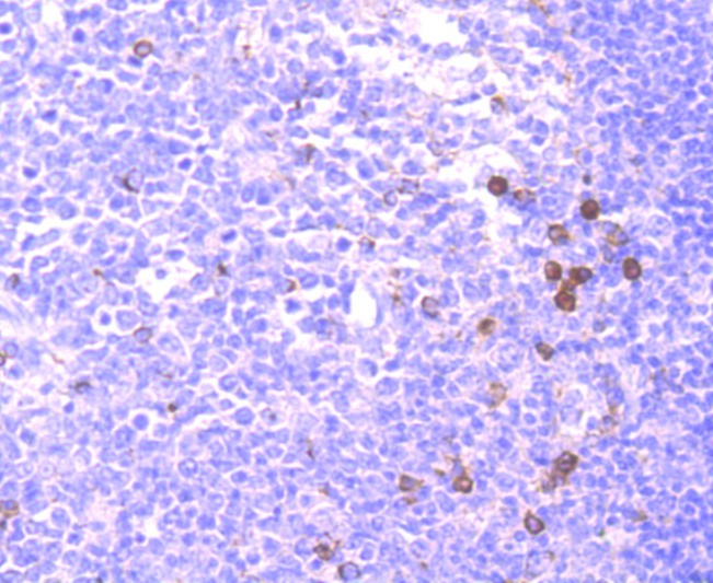 Fig7: Immunohistochemical analysis of paraffin-embedded human tonsil tissue using anti-CD137 antibody. Counter stained with hematoxylin.