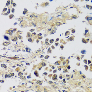 Immunohistochemistry - C12orf10 Polyclonal Antibody 