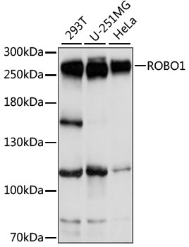 Western blot - ROBO1 Polyclonal Antibody 