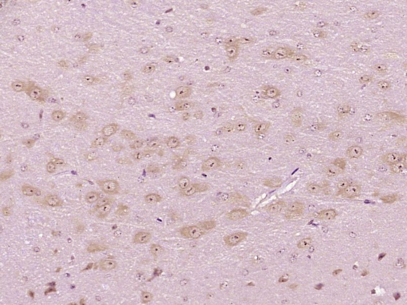 Fig2: Paraformaldehyde-fixed, paraffin embedded (Mouse brain); Antigen retrieval by boiling in sodium citrate buffer (pH6.0) for 15min; Block endogenous peroxidase by 3% hydrogen peroxide for 20 minutes; Blocking buffer (normal goat serum) at 37℃ for 30min; Antibody incubation with (CXorf36) Polyclonal Antibody, Unconjugated at 1:400 overnight at 4℃, followed by operating according to SP Kit(Rabbit) (sp-0023) instructionsand DAB staining.