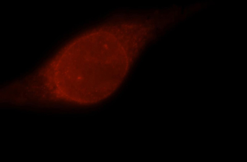 Immunofluorescent analysis of Hela cells, using POLDIP2 antibody Catalog No:114000 at 1:25 dilution and Rhodamine-labeled goat anti-rabbit IgG (red).