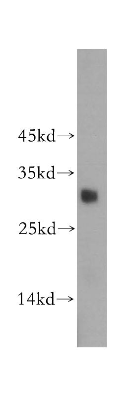 human testis tissue were subjected to SDS PAGE followed by western blot with Catalog No:115603(SRY antibody) at dilution of 1:500