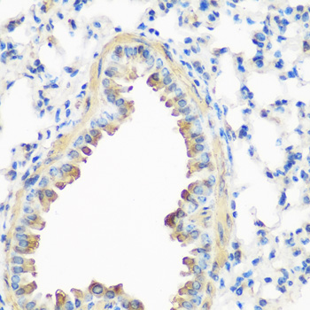 Immunohistochemistry - CAV3 Polyclonal Antibody 