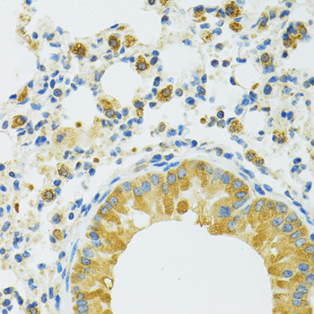 Immunohistochemistry - SLC37A4 Polyclonal Antibody 