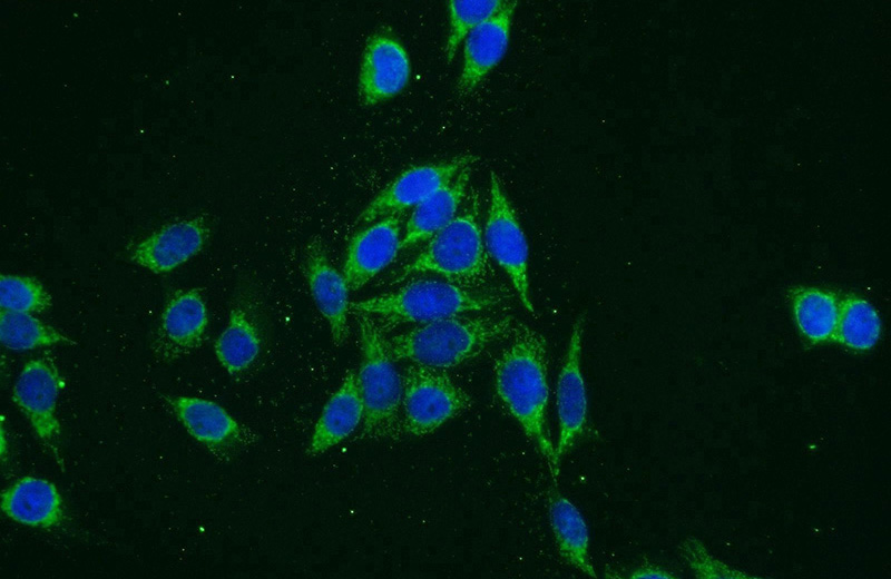 Immunofluorescent analysis of HeLa cells using Catalog No:109381(COL4A6 Antibody) at dilution of 1:25 and Alexa Fluor 488-congugated AffiniPure Goat Anti-Rabbit IgG(H+L)