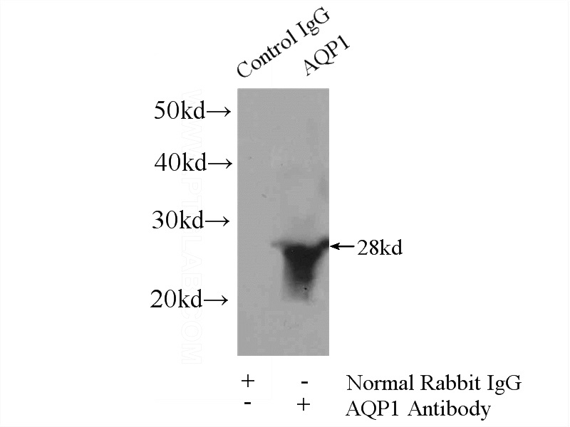 IP Result of anti-AQP1 (IP:Catalog No:108045, 4ug; Detection:Catalog No:108045 1:1500) with mouse skeletal muscle tissue lysate 3600ug.