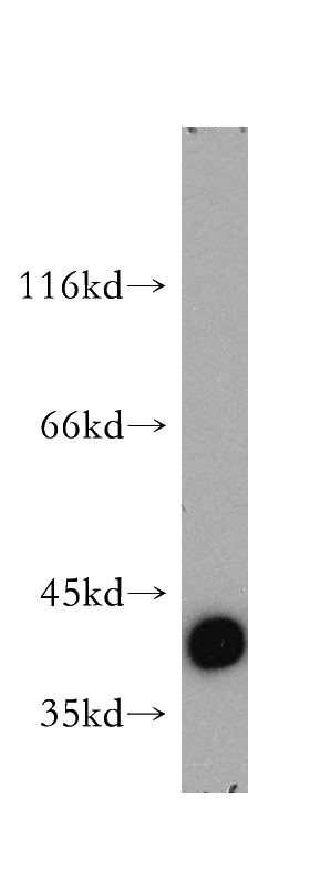 mouse cerebellum tissue were subjected to SDS PAGE followed by western blot with Catalog No:107978(ALDoc antibody) at dilution of 1:800