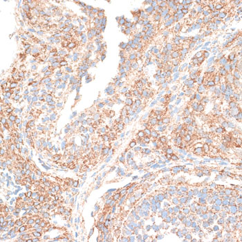 Immunohistochemistry - KIF14 Polyclonal Antibody 