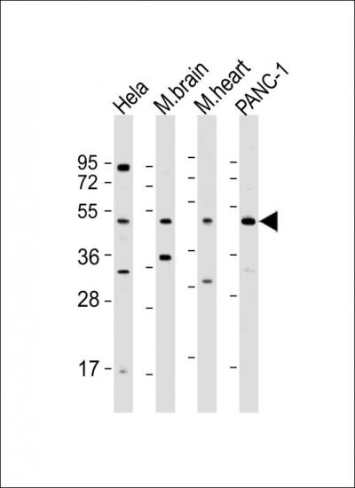 All lanes: Anti-WNT5A Antibody (Center) at 1:500 dilution Lane 1: Hela whole cell lysate Lane 2: mouse brain lysate Lane 3: mouse heart lysate Lane 4: PANC-1 whole cell lysate Lysates/proteins at 20 μg per lane. Secondary Goat Anti-Rabbit IgG, (H+L), Peroxidase conjugated at 1/10000 dilution. Predicted band size: 42 kDa Blocking/Dilution buffer: 5% NFDM/TBST.