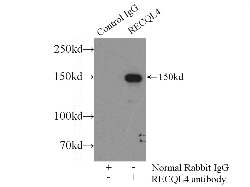 IP Result of anti-RECQL4 (IP:Catalog No:114676, 4ug; Detection:Catalog No:114676 1:1000) with HeLa cells lysate 2500ug.
