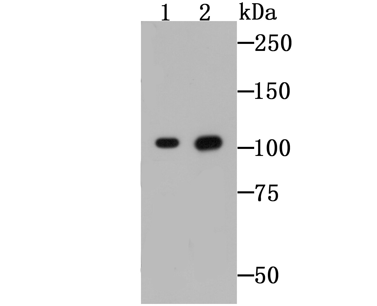 Fig2: Western blot analysis of CD130 on Raji cell (1) and mouse lung tissue (2) lysates using anti-CD130 antibody at 1/500 dilution.