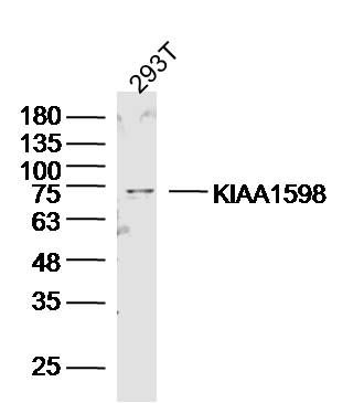 Fig1: Sample:293T Cell (Human) Lysate at 40 ug; Primary: Anti-KIAA1598 at 1/300 dilution; Secondary: IRDye800CW Goat Anti-Rabbit IgG at 1/20000 dilution; Predicted band size: 72kD; Observed band size: 72kD