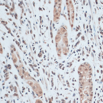 Immunohistochemistry - ZNF416 Polyclonal Antibody 