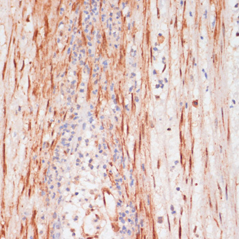 Immunohistochemistry - Phospho-PEA15-S104 pAb 