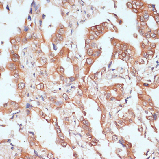 Immunohistochemistry - PTPRN2 Polyclonal Antibody 