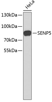Western blot - SENP5 Polyclonal Antibody 