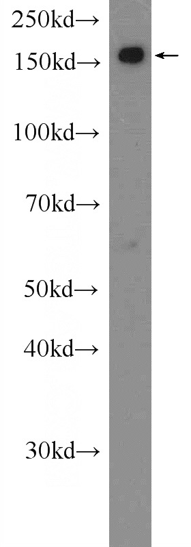 MCF-7 cells were subjected to SDS PAGE followed by western blot with Catalog No:115381(SMC4 Antibody) at dilution of 1:2000