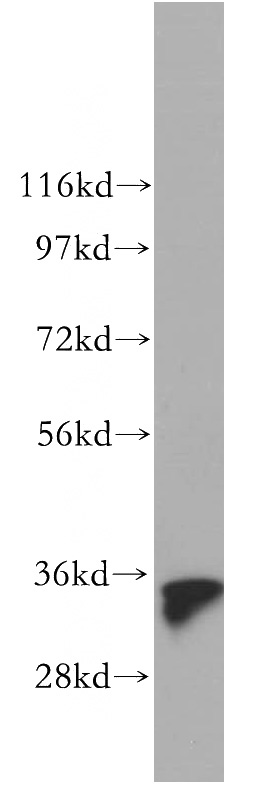 mouse brain tissue were subjected to SDS PAGE followed by western blot with Catalog No:110960(GGPS1 antibody) at dilution of 1:500