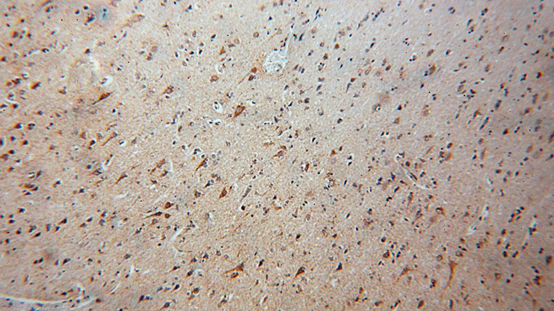 Immunohistochemical of paraffin-embedded human brain using Catalog No:113061(NDUFA5 antibody) at dilution of 1:50 (under 10x lens)
