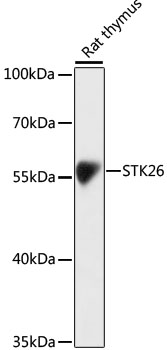 Western blot - STK26 Polyclonal Antibody 