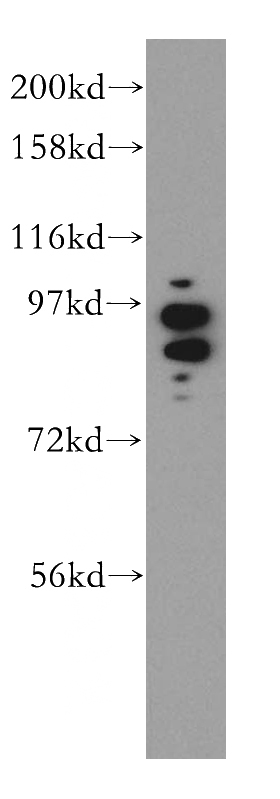 mouse testis tissue were subjected to SDS PAGE followed by western blot with Catalog No:113670(PDE8A antibody) at dilution of 1:1000