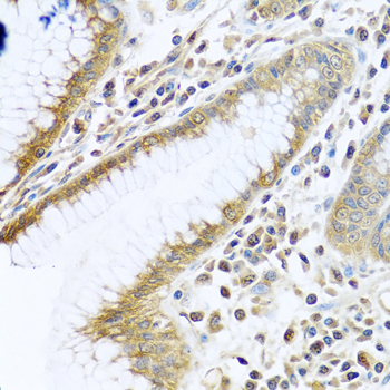 Immunohistochemistry - TMEM189 Polyclonal Antibody 