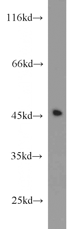 Jurkat cells were subjected to SDS PAGE followed by western blot with Catalog No:111952(ITM2A antibody) at dilution of 1:1000