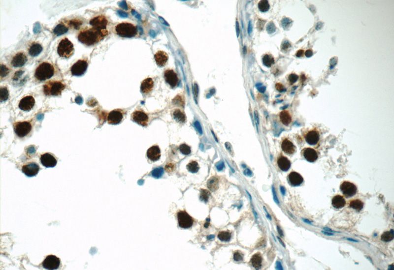 Immunohistochemistry of paraffin-embedded human testis tissue slide using Catalog No:109726(CTNNBL1 Antibody) at dilution of 1:50 (under 40x lens)