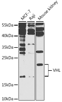Western blot - VHL Polyclonal Antibody 
